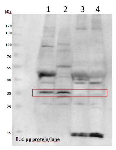 western blot using anti-VPS26 antibodies